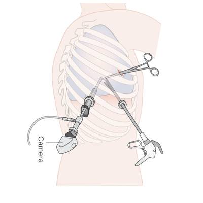 Bronchoscopy Doctor In Varanasi
