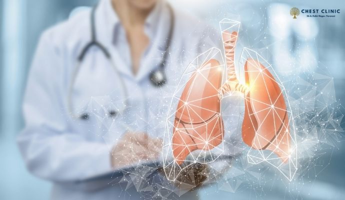 ILD-doctor-in-varanasi